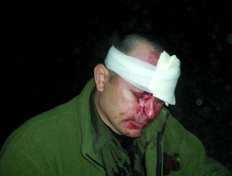injuredbp.jpg